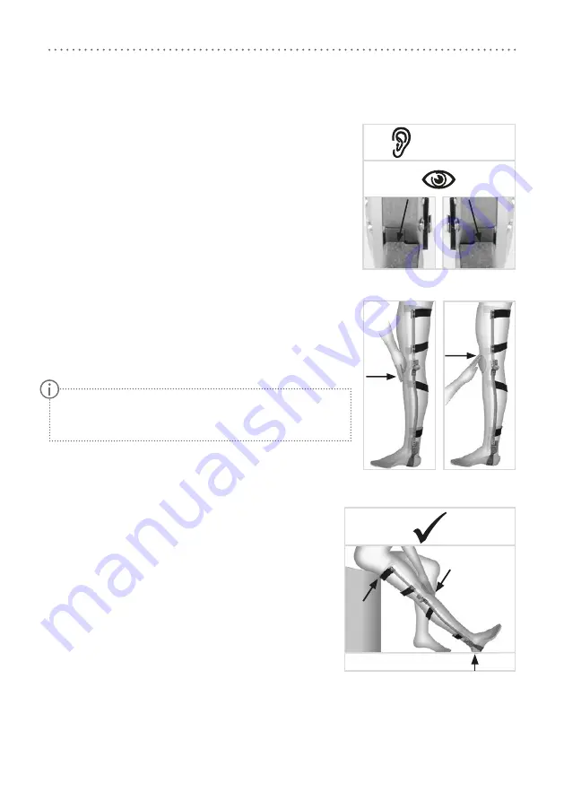 FIOR & GENTZ Locked System Knee Joints Скачать руководство пользователя страница 6