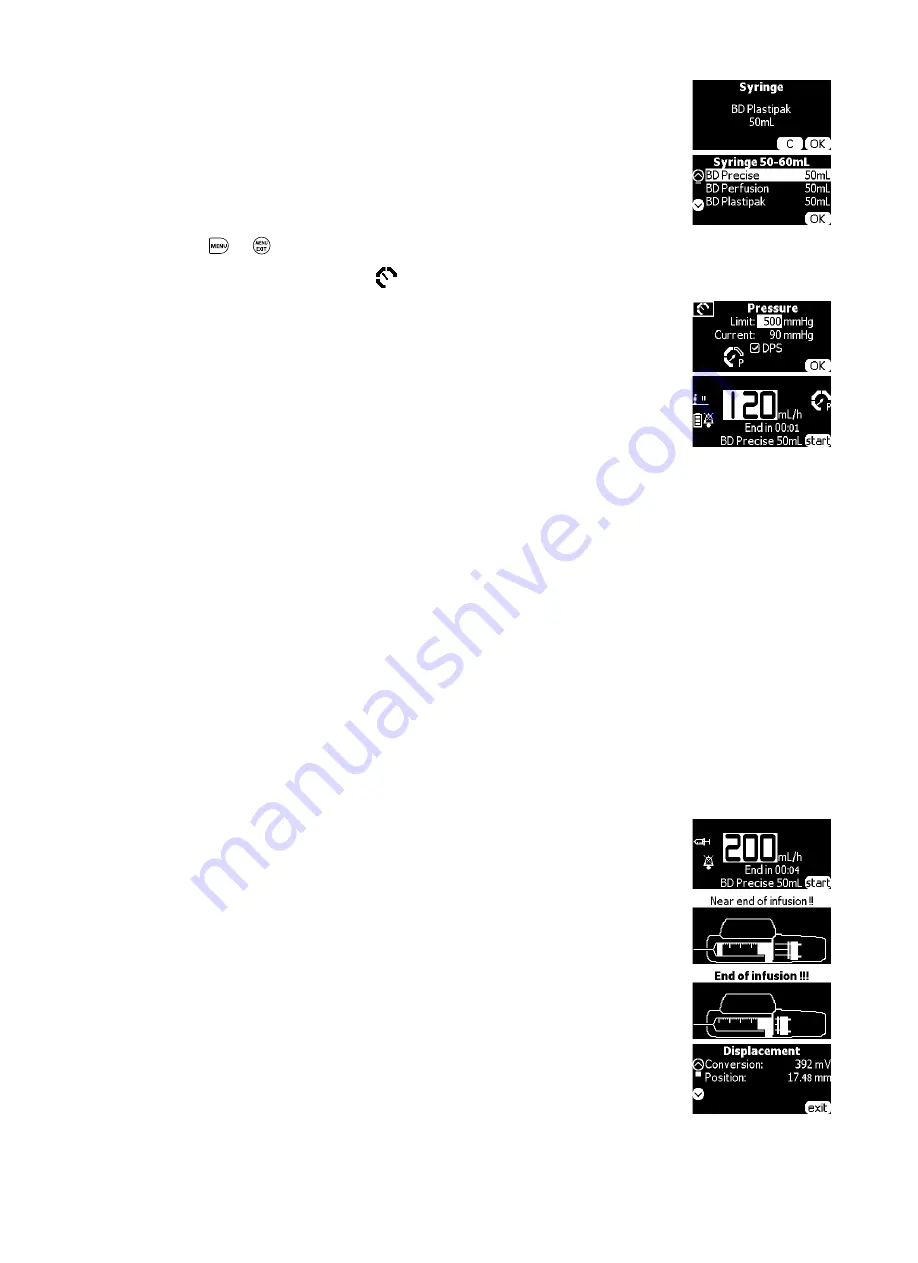 Fresenius Kabi Agilia SP Technical Manual Download Page 61