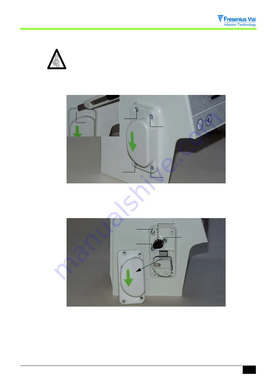 Fresenius Kabi OPTIMA PT-VS-S Скачать руководство пользователя страница 83