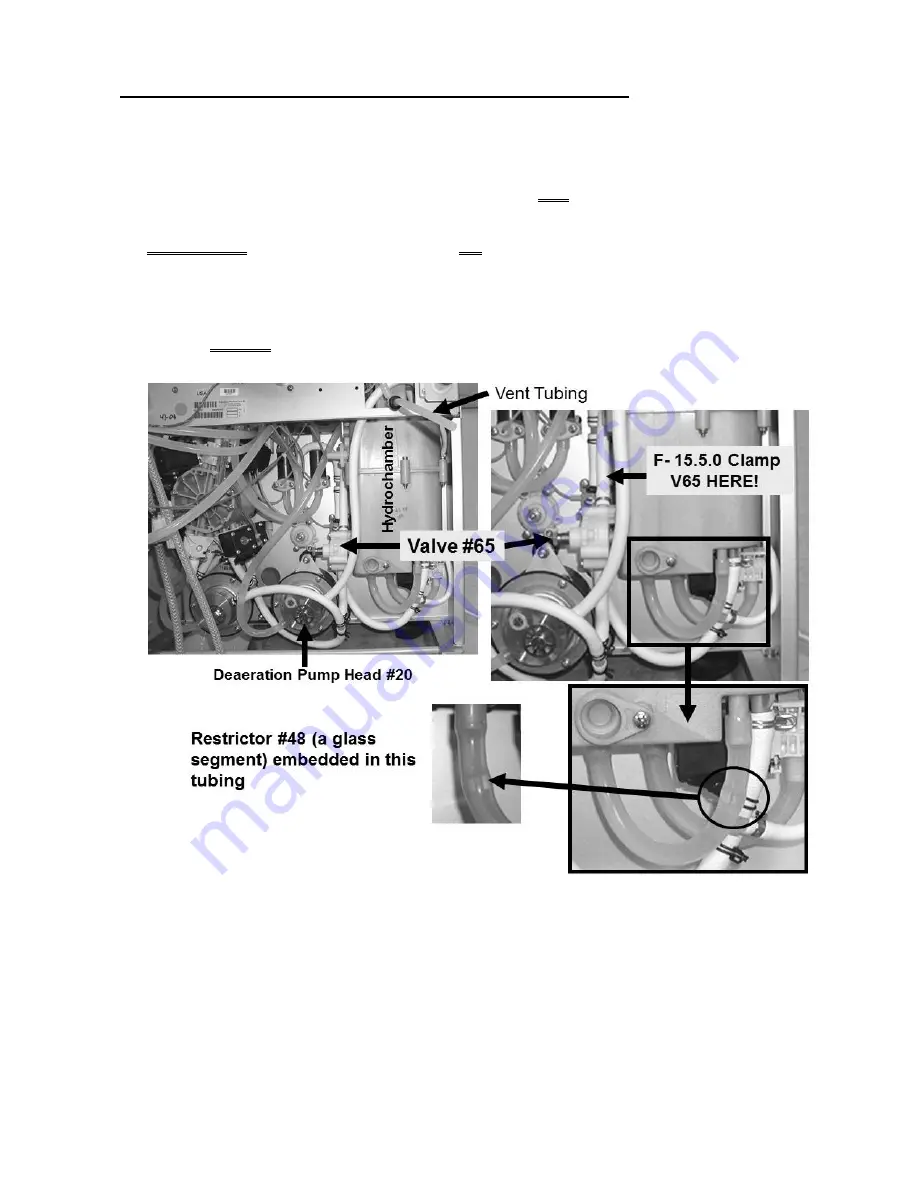 Fresenius Medical Care 2008K2 Скачать руководство пользователя страница 124