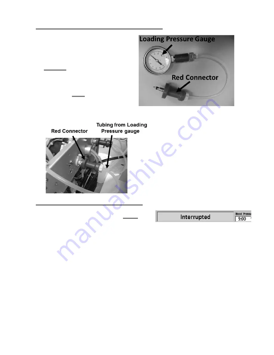 Fresenius Medical Care 2008K2 Скачать руководство пользователя страница 163