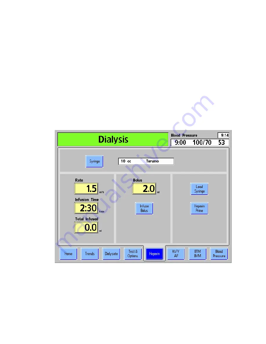 Fresenius Medical Care DIASAFE 2008 K Operator'S Manual Download Page 84