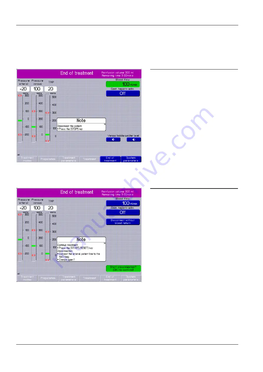 Fresenius Medical Care multiFiltrate Скачать руководство пользователя страница 72