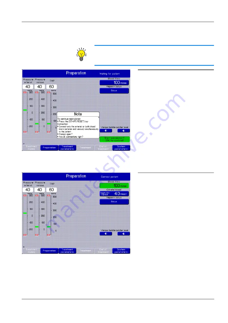 Fresenius Medical Care multiFiltrate Скачать руководство пользователя страница 85