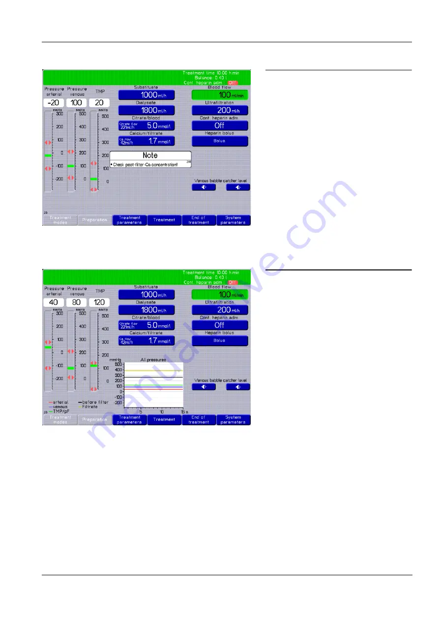 Fresenius Medical Care multiFiltrate Скачать руководство пользователя страница 87