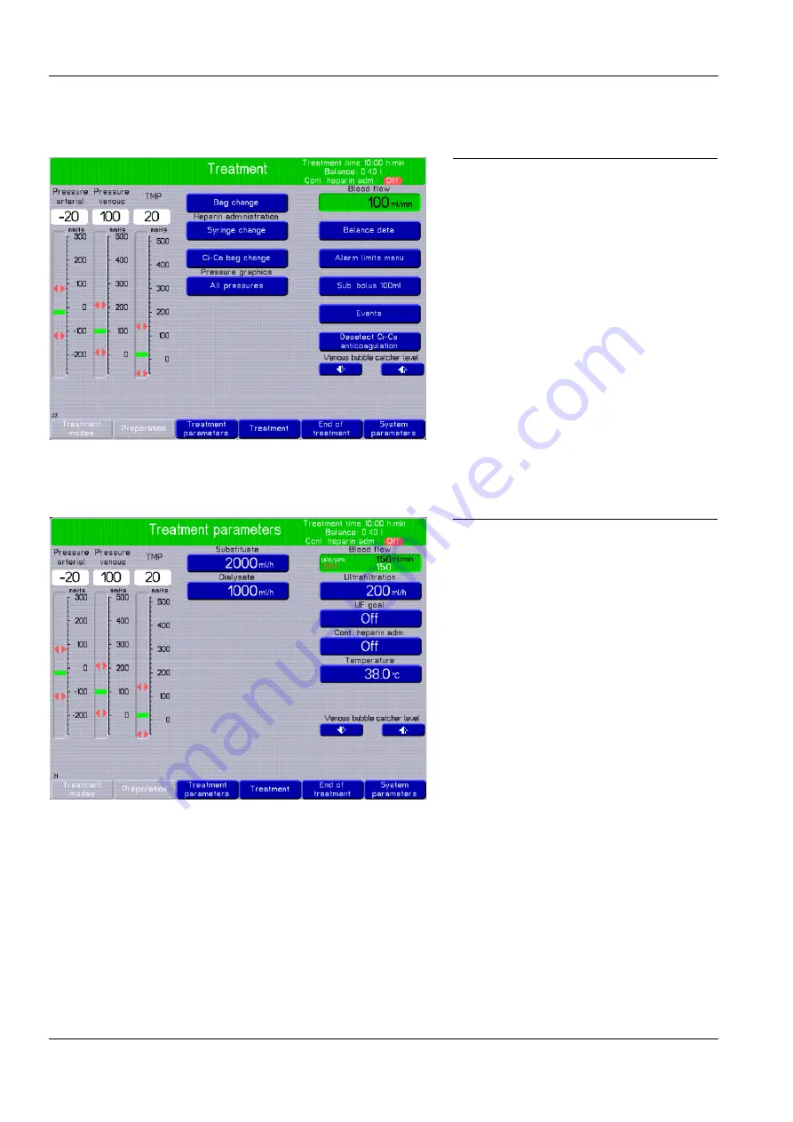 Fresenius Medical Care multiFiltrate Скачать руководство пользователя страница 88