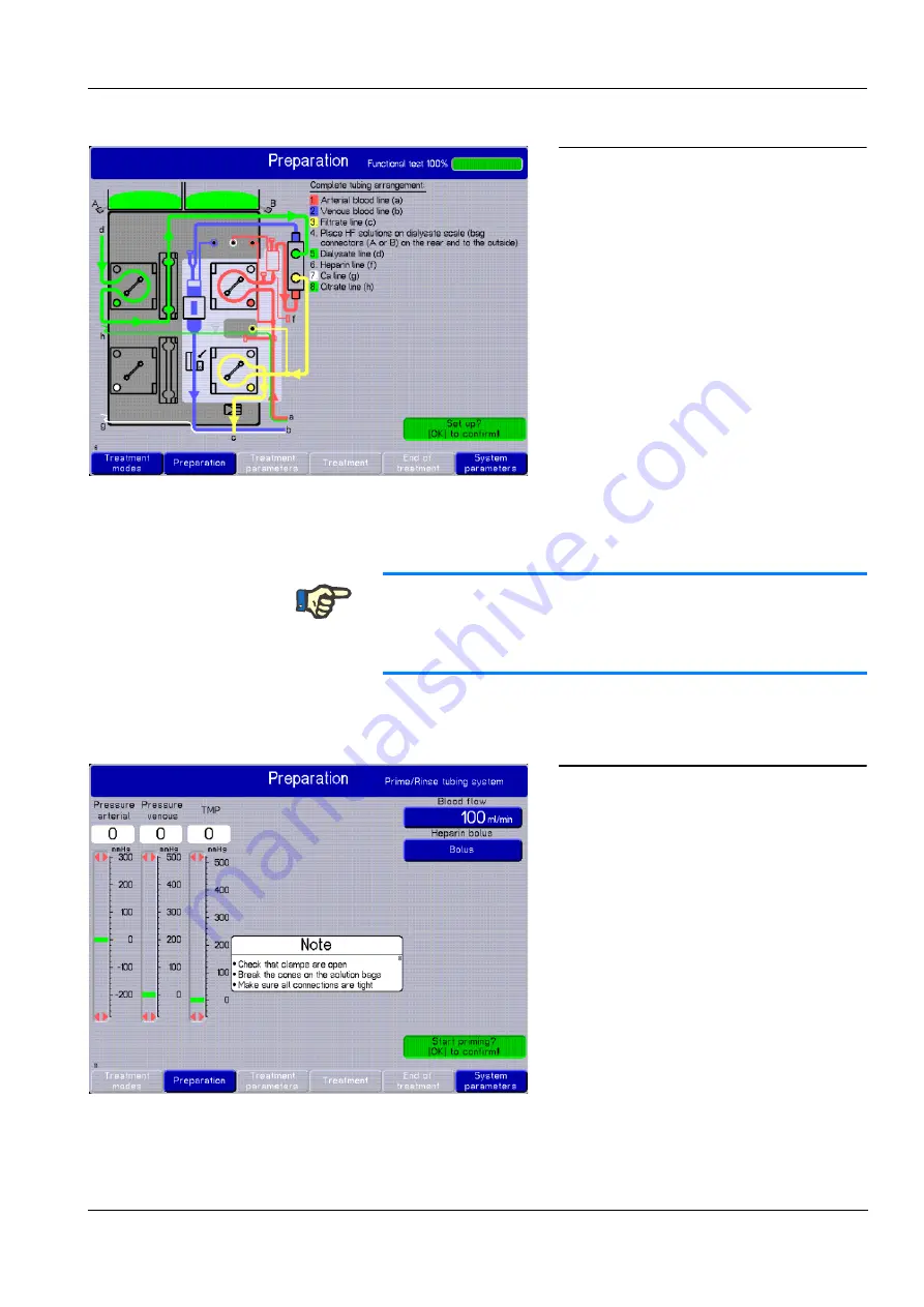 Fresenius Medical Care multiFiltrate Скачать руководство пользователя страница 97