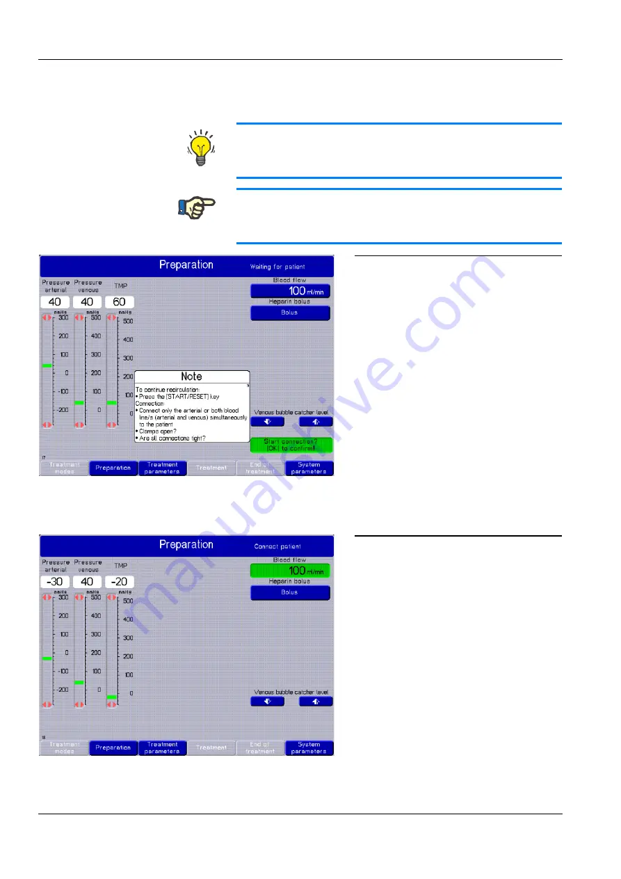 Fresenius Medical Care multiFiltrate Скачать руководство пользователя страница 100