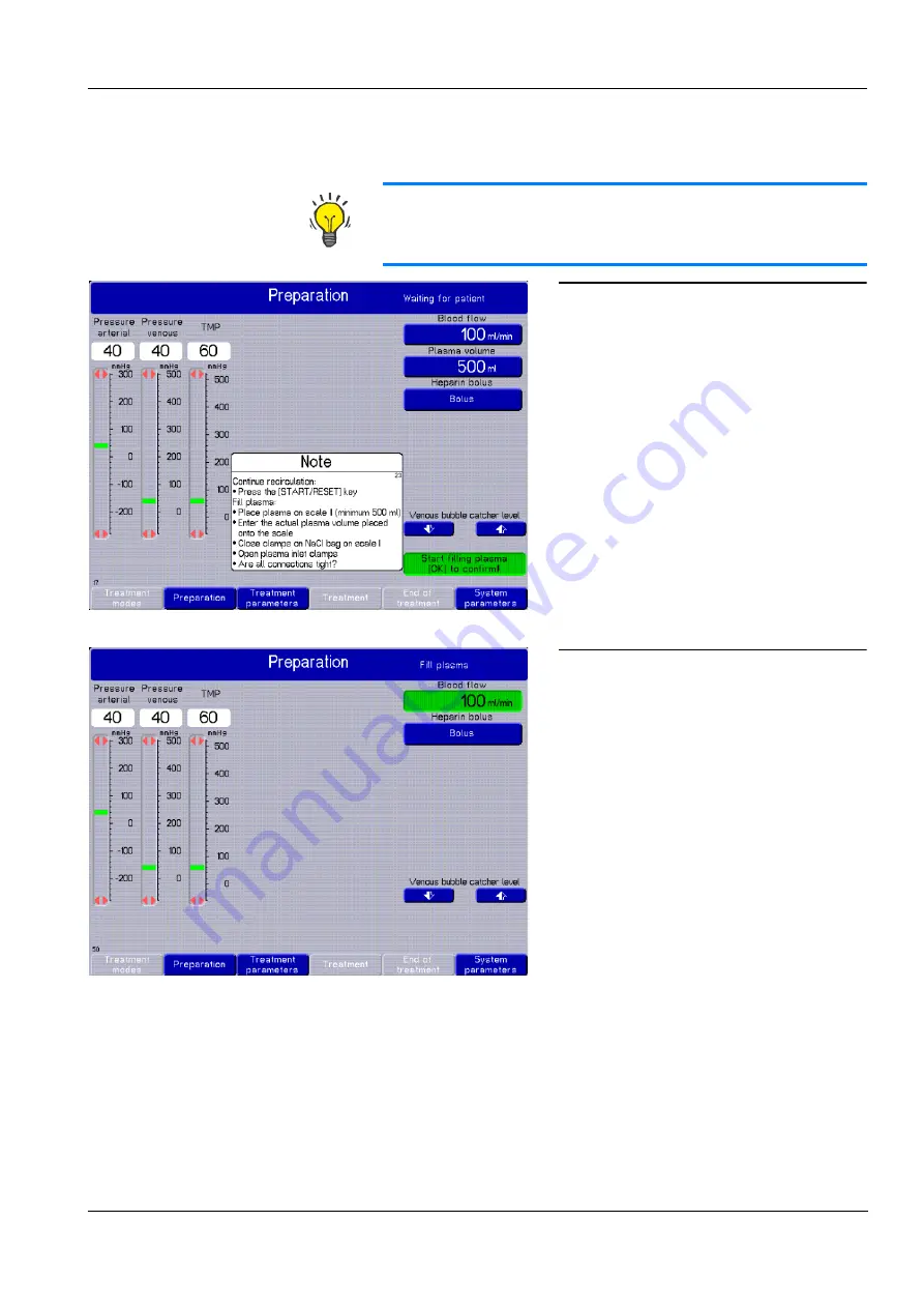 Fresenius Medical Care multiFiltrate Скачать руководство пользователя страница 113