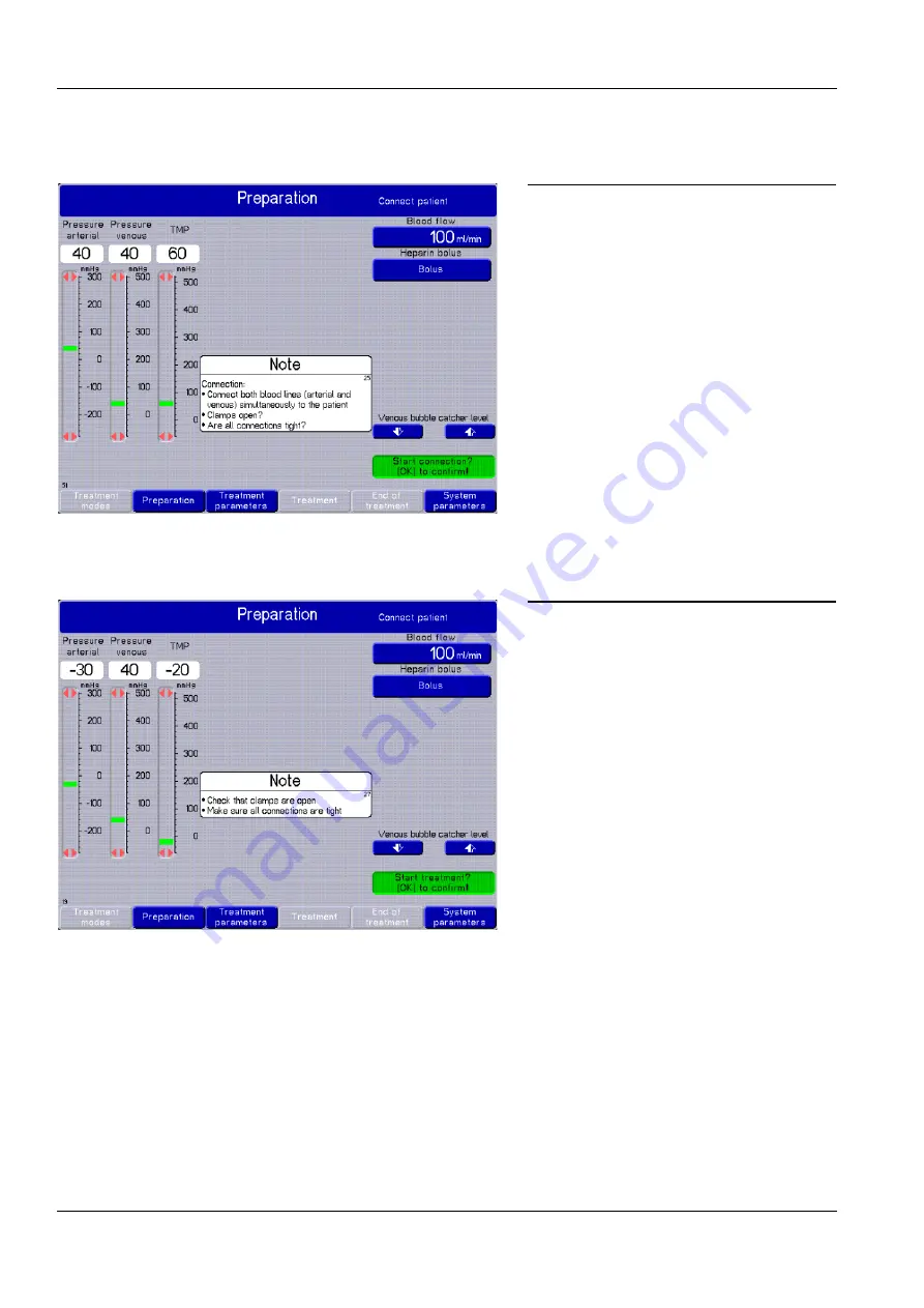 Fresenius Medical Care multiFiltrate Скачать руководство пользователя страница 114