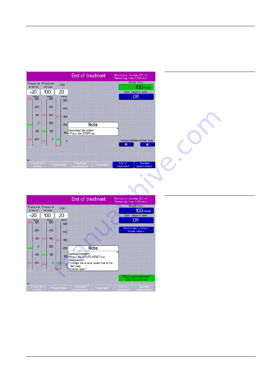 Fresenius Medical Care multiFiltrate Скачать руководство пользователя страница 131