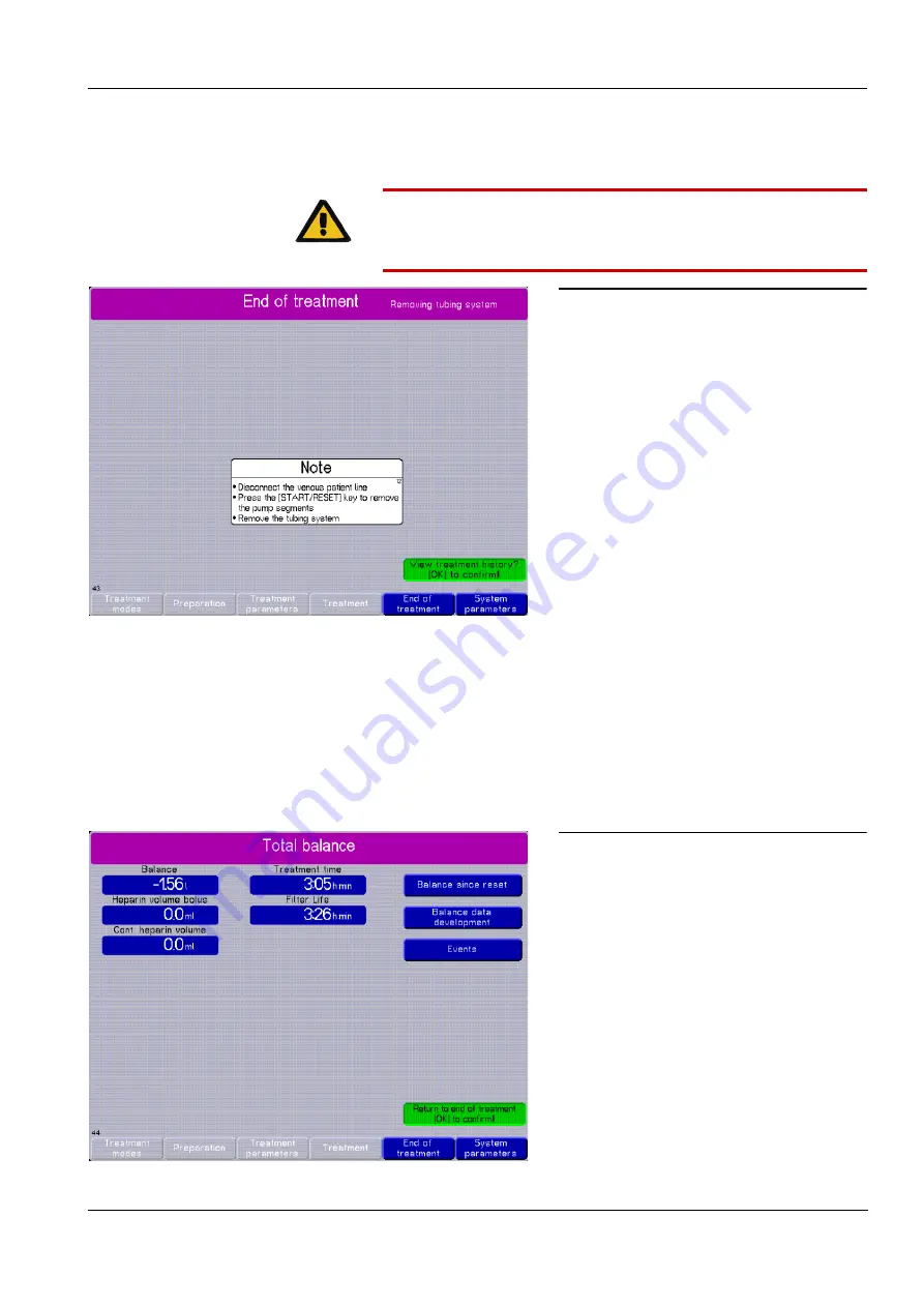 Fresenius Medical Care multiFiltrate Скачать руководство пользователя страница 133