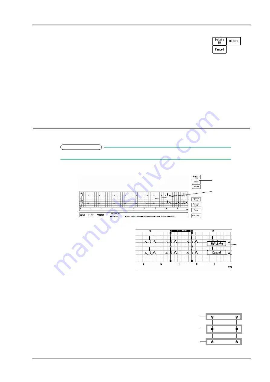 Fukuda DYASCOPE 8000 Series Скачать руководство пользователя страница 181