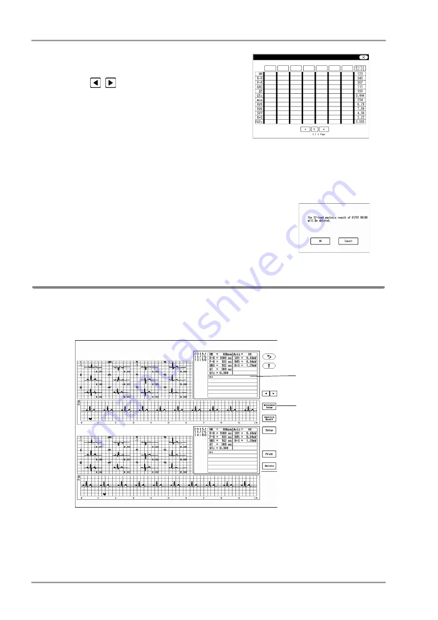 Fukuda DYASCOPE 8000 Series Operation Manual Download Page 196