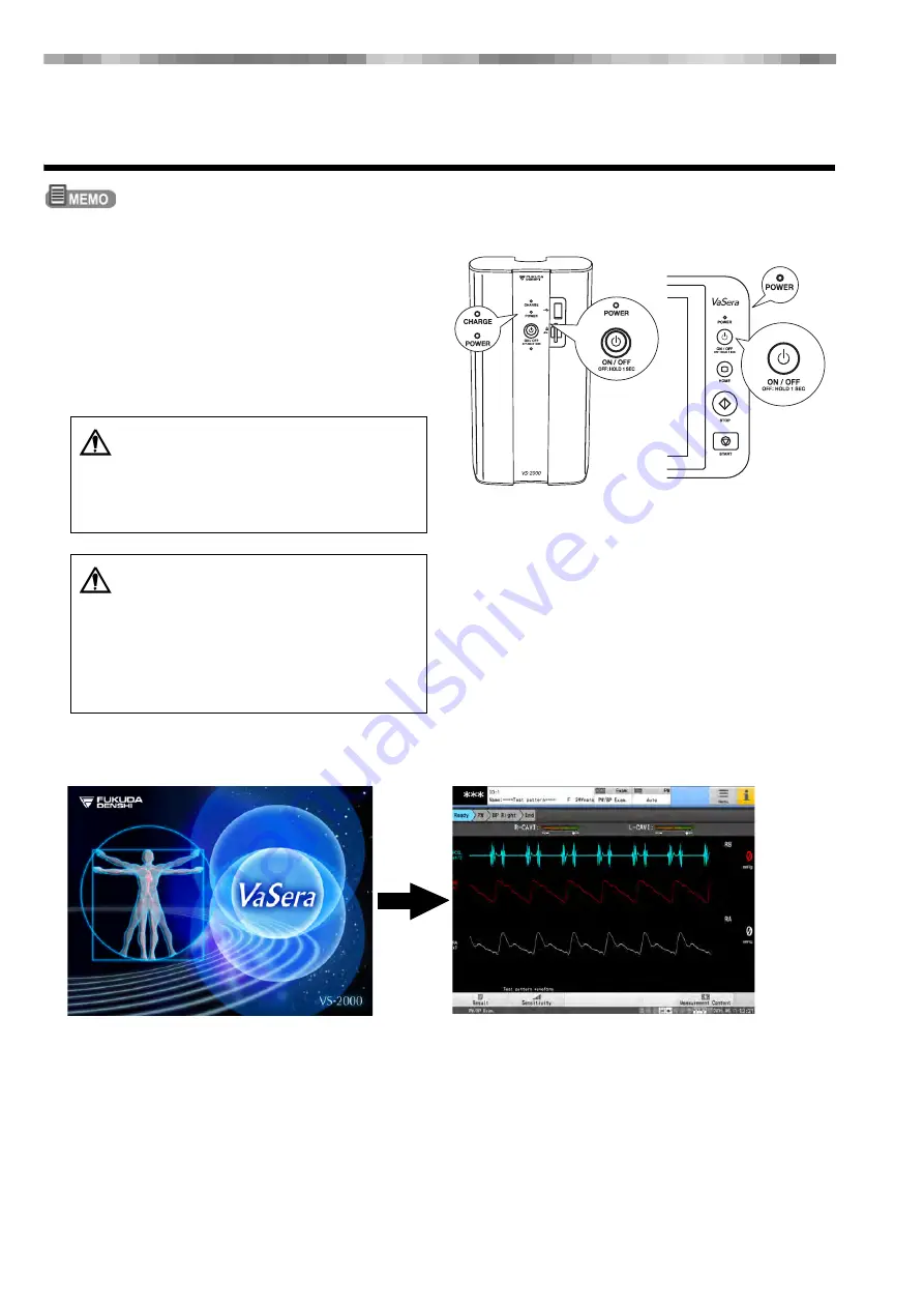 Fukuda VaSera VS-2000 Series Operation Manual Download Page 62