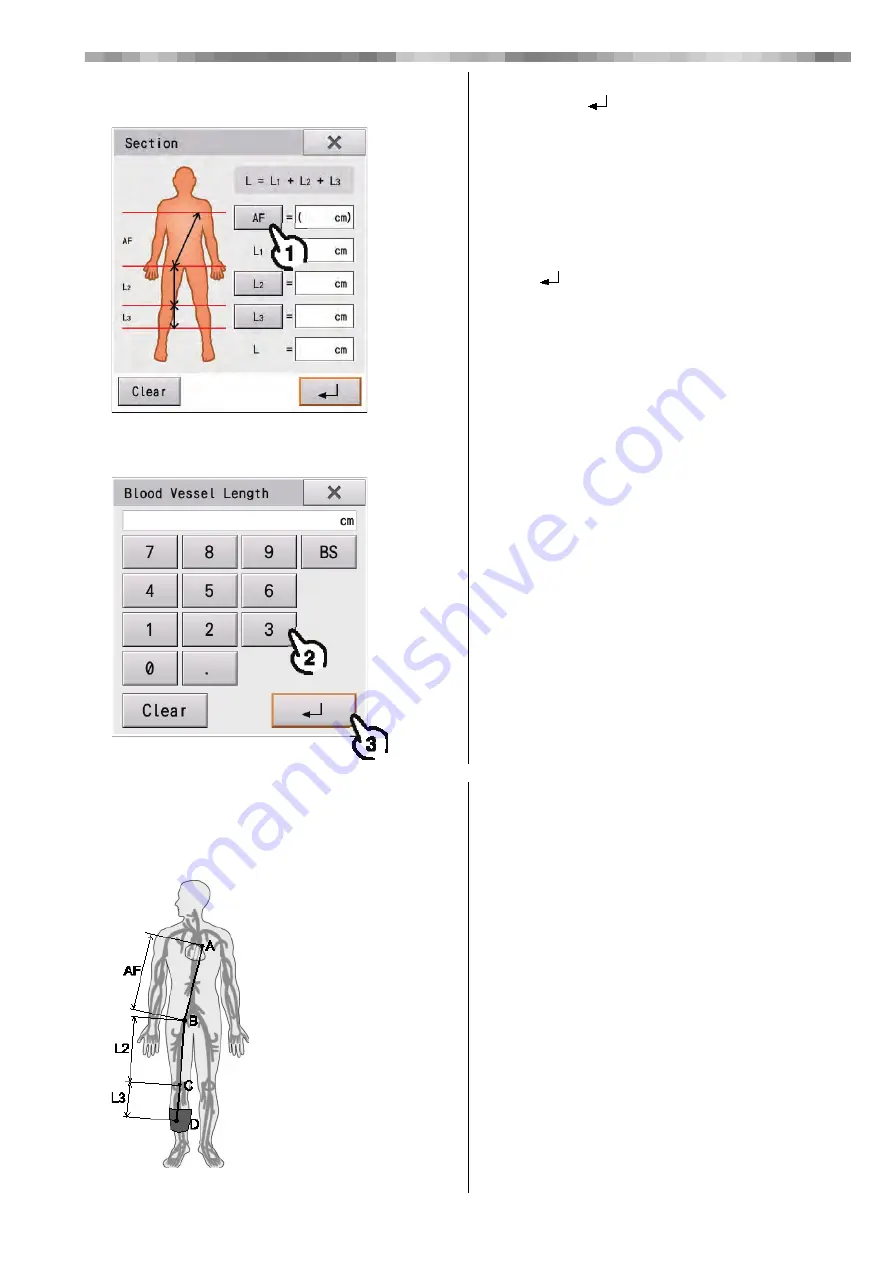 Fukuda VaSera VS-2000 Series Operation Manual Download Page 111