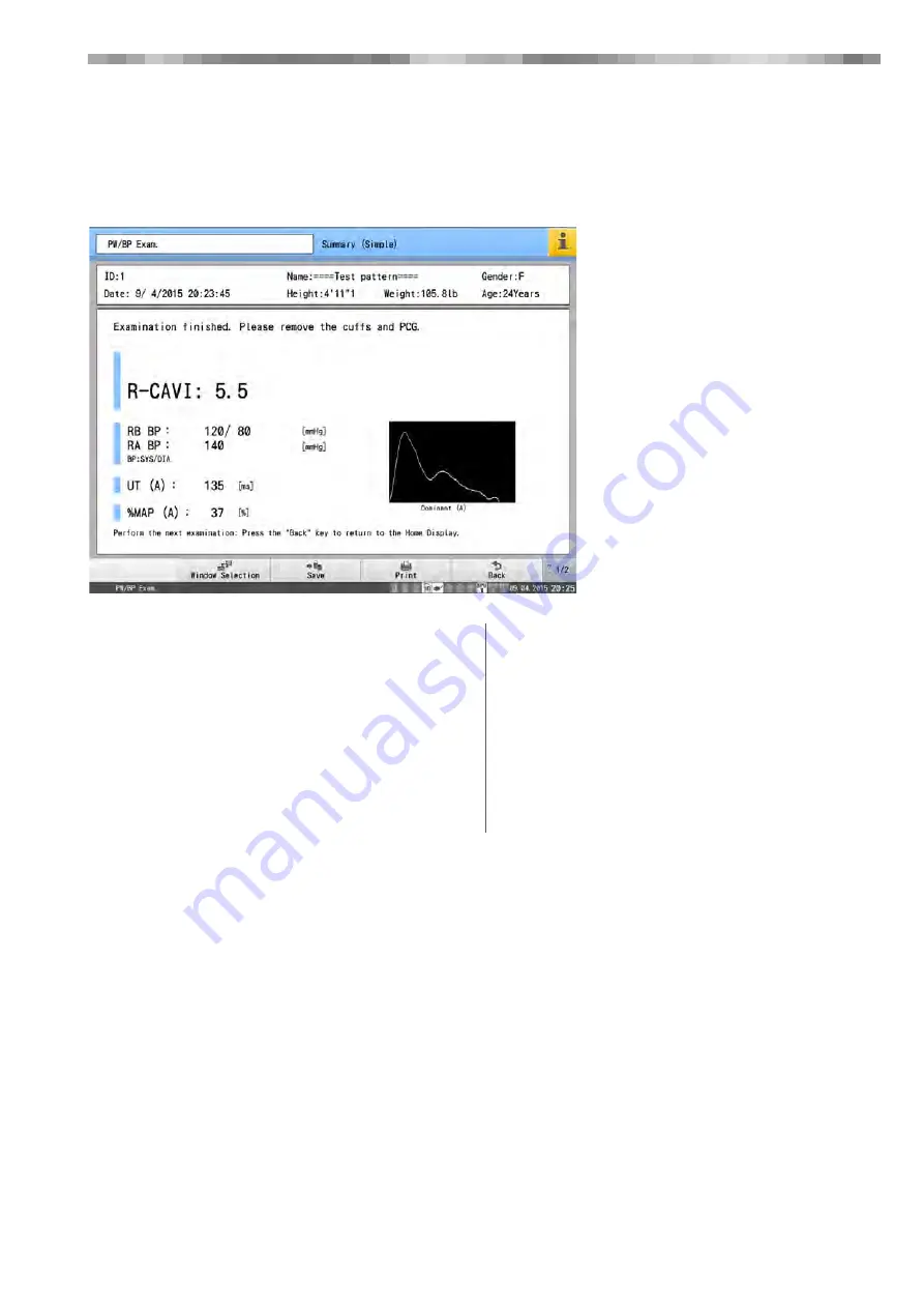 Fukuda VaSera VS-2000 Series Operation Manual Download Page 129