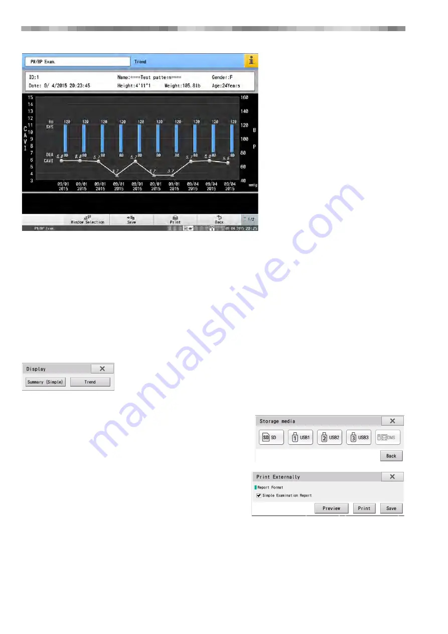 Fukuda VaSera VS-2000 Series Operation Manual Download Page 130