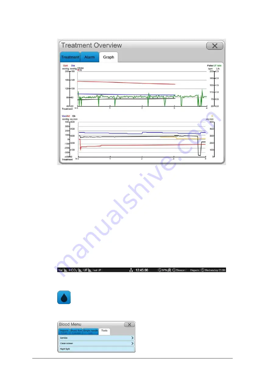 Gambro AK 98 Operator'S Manual Download Page 70