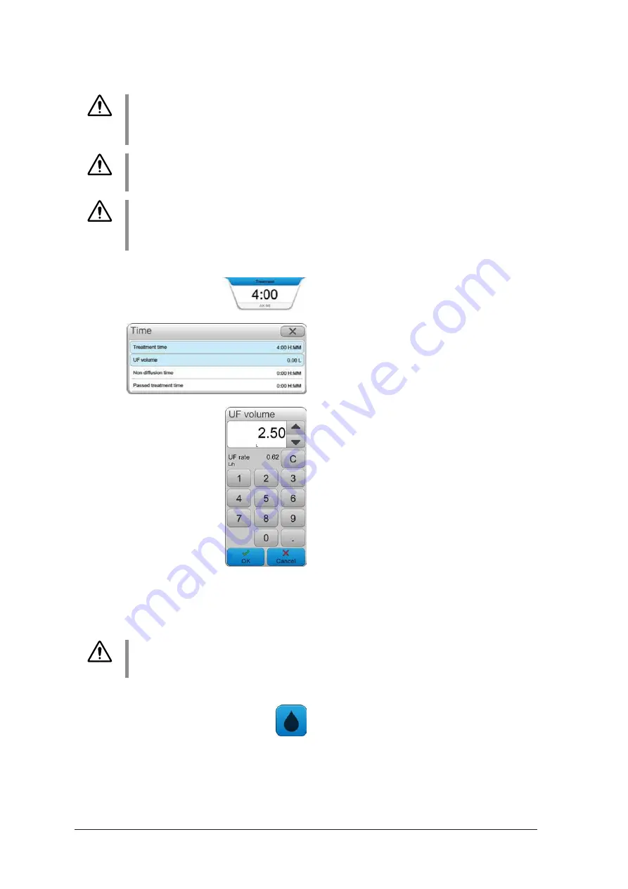 Gambro AK 98 Operator'S Manual Download Page 98