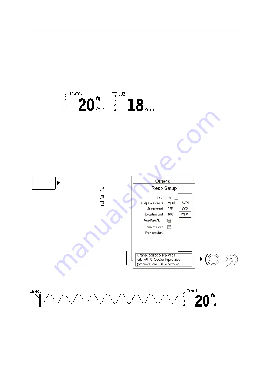 GE HEALTHCARE B20 User'S Reference Manual Download Page 209