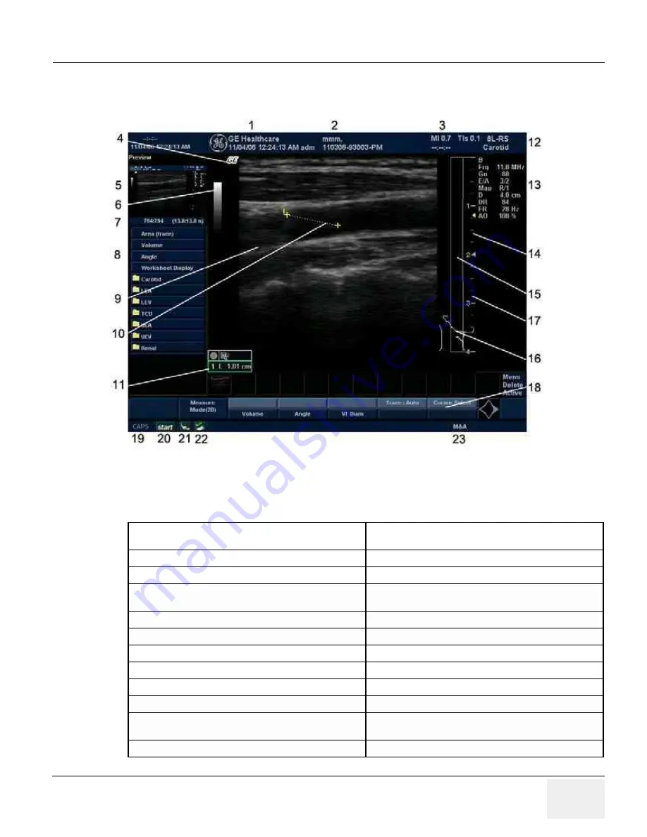 GE HEALTHCARE Logiq Book XP series Скачать руководство пользователя страница 115