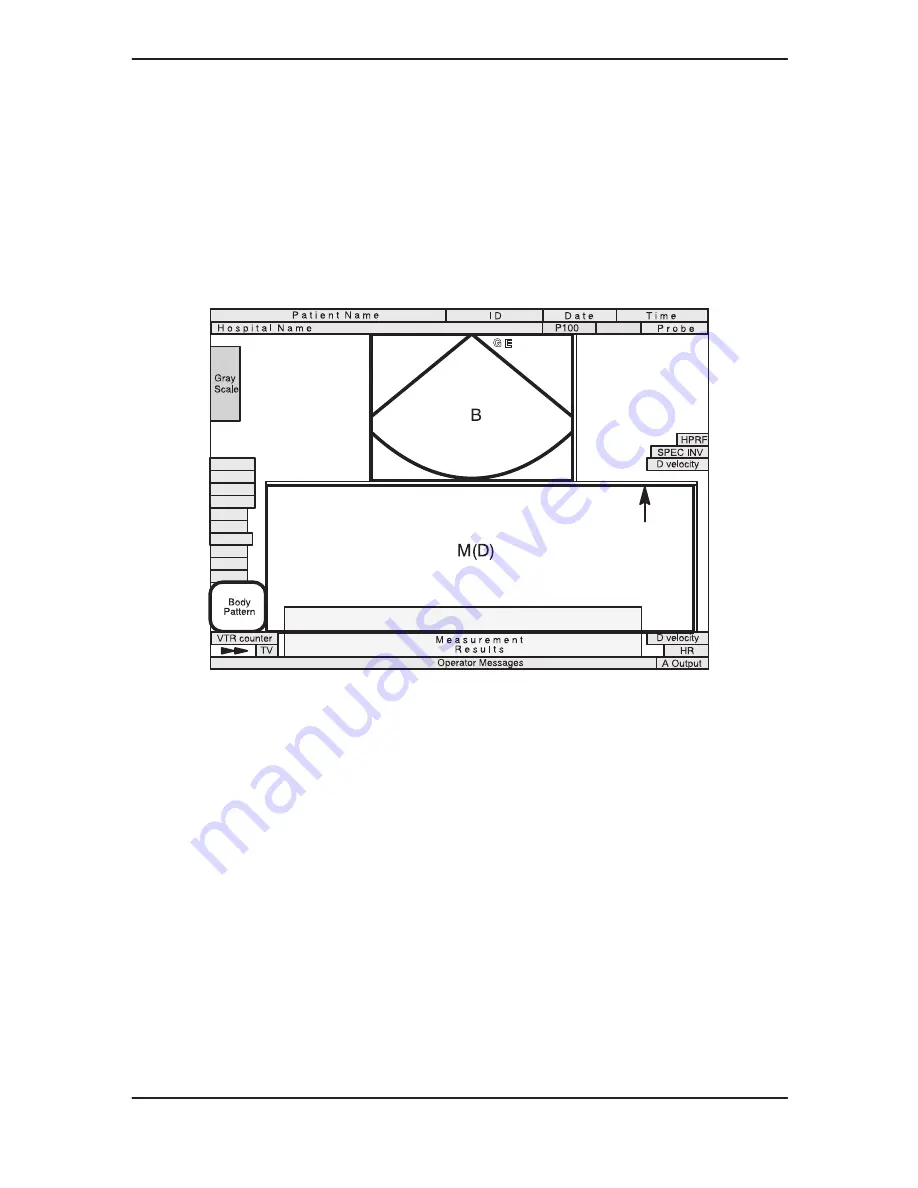 GE Medical Systems 500 User Manual Download Page 195