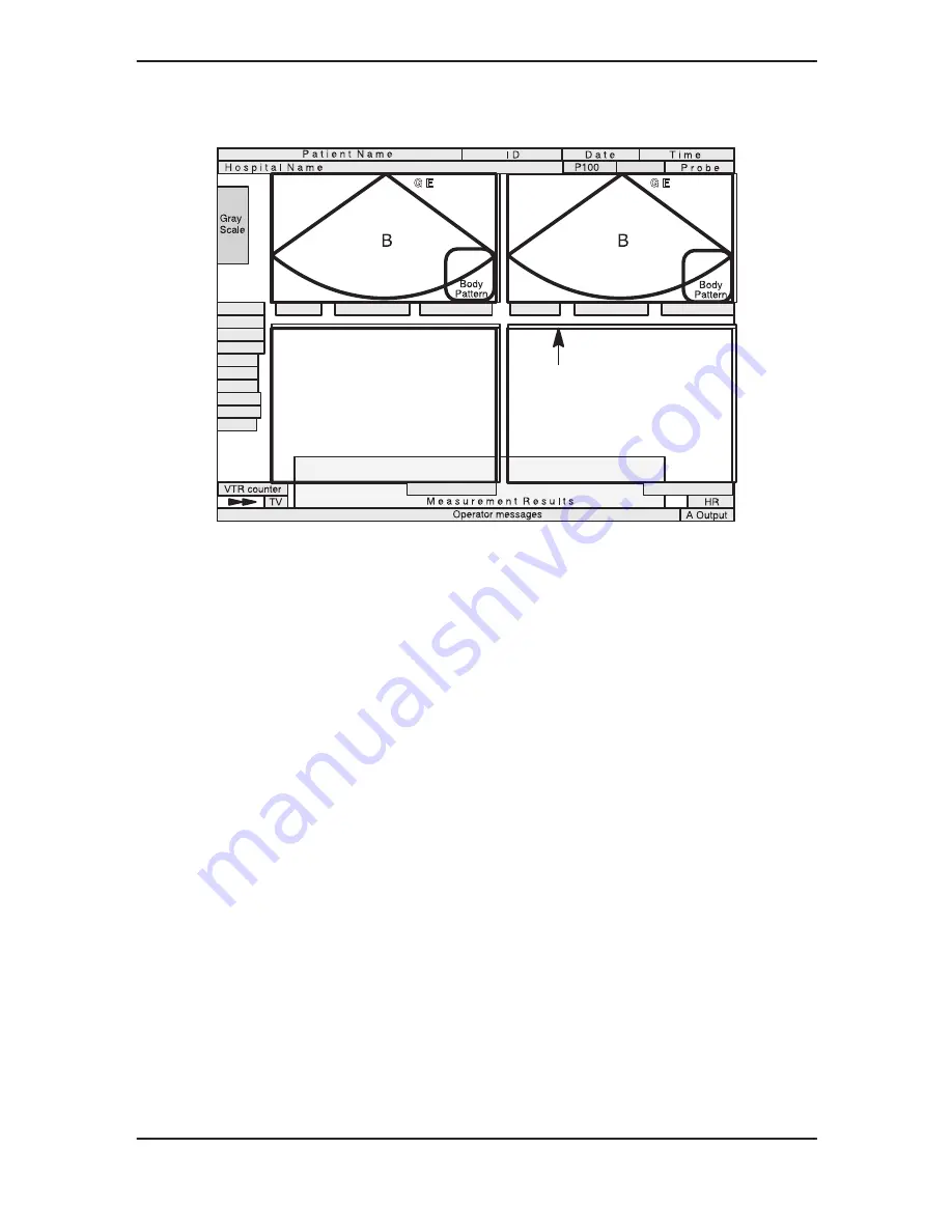 GE Medical Systems 500 User Manual Download Page 198