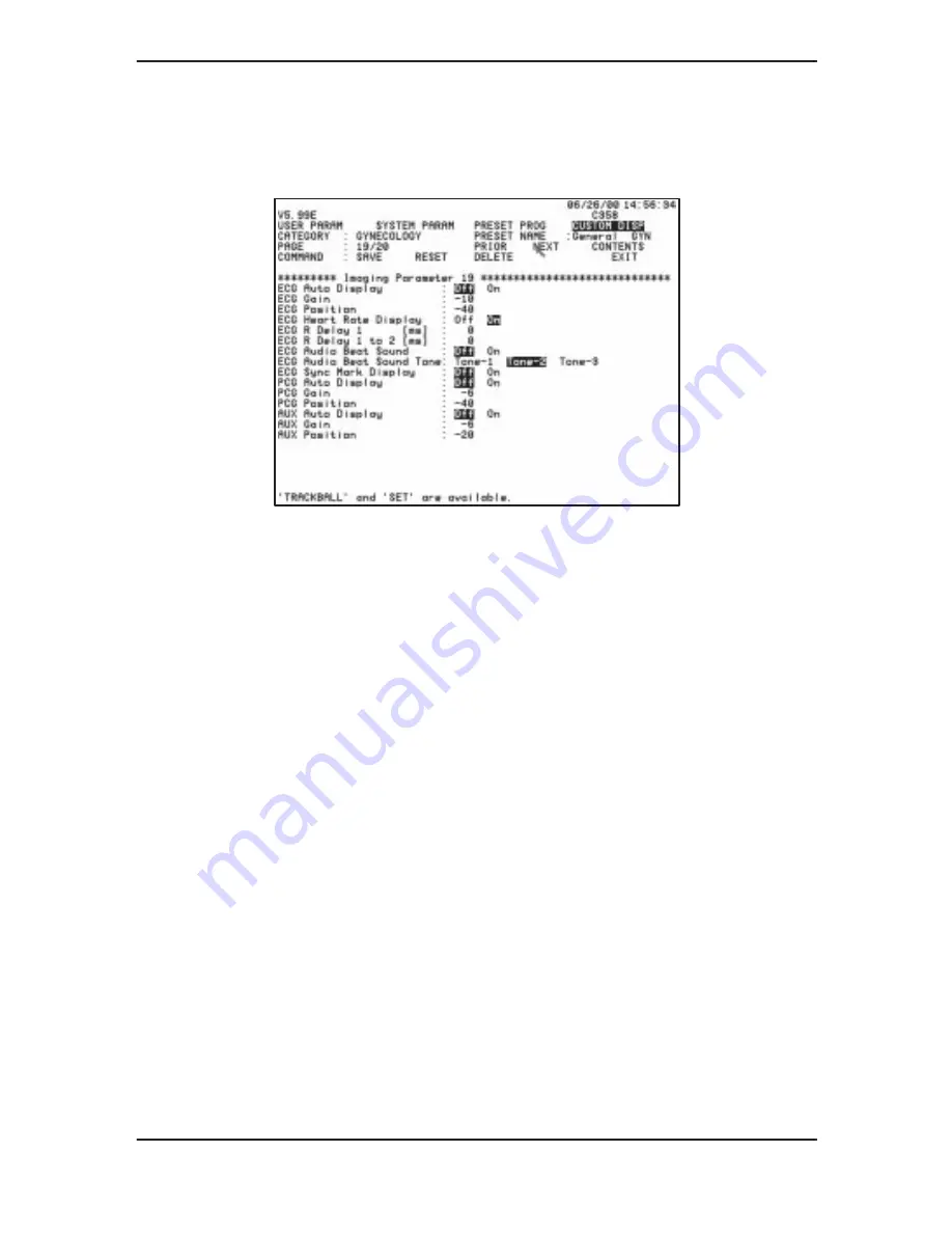 GE Medical Systems 500 User Manual Download Page 413