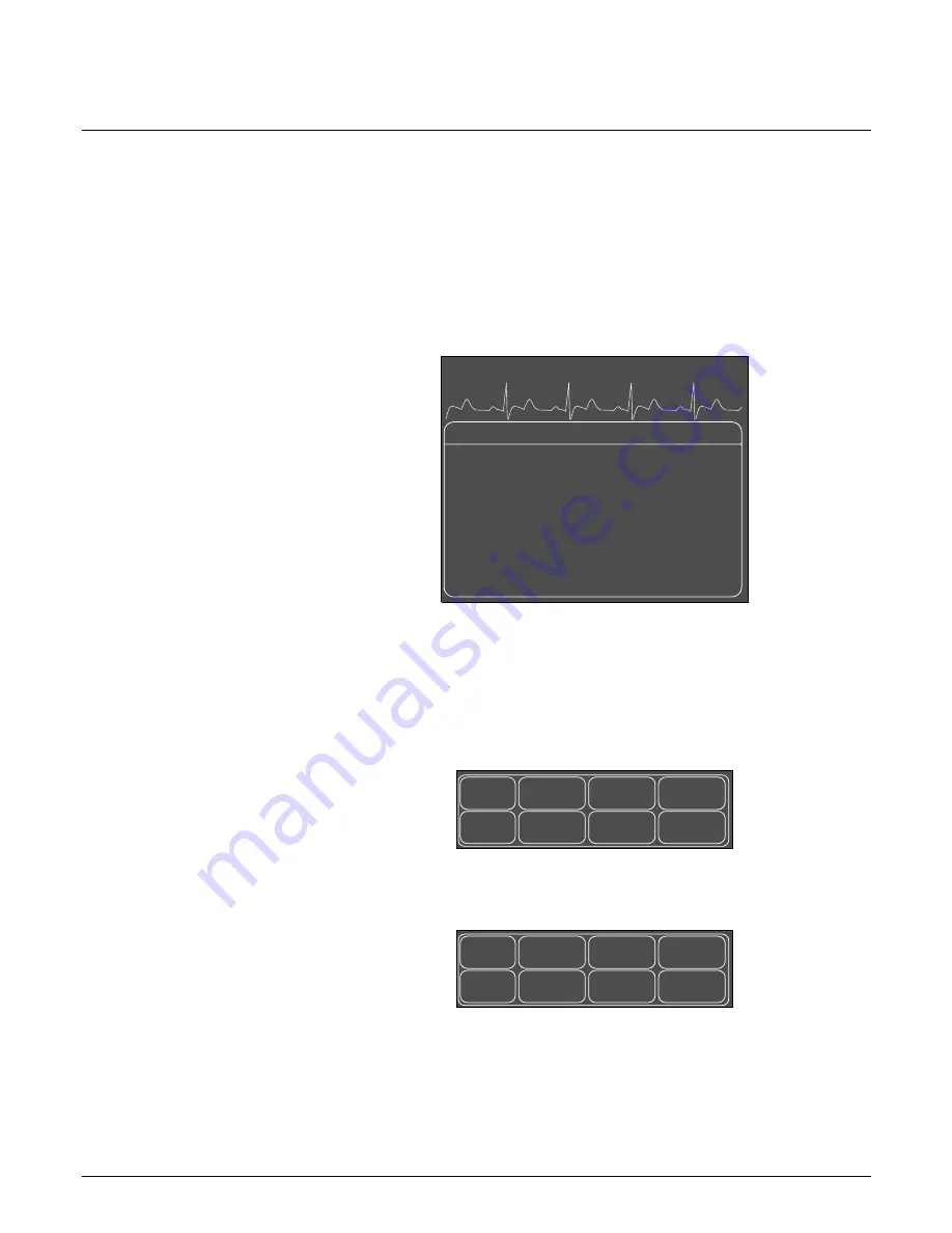 GE Medical Systems marquette Dash 2000 Скачать руководство пользователя страница 73