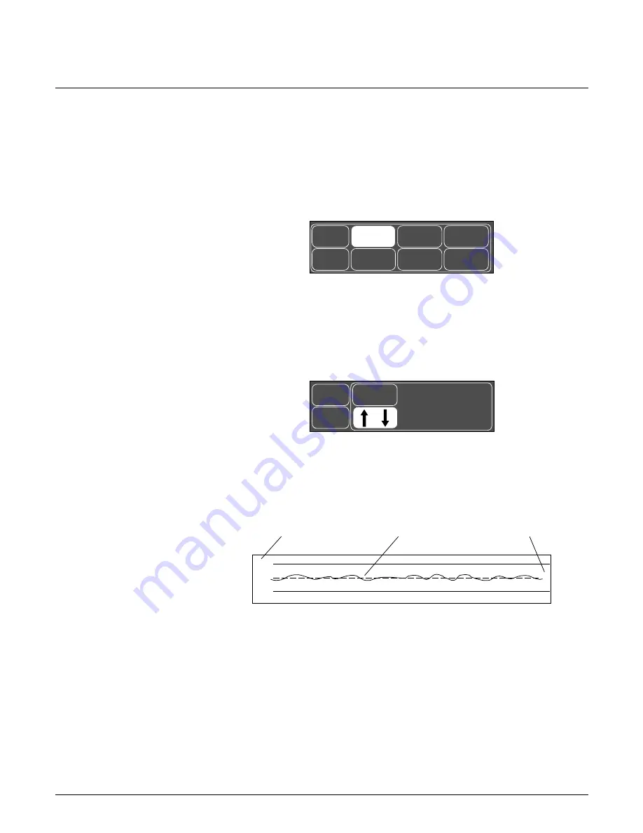 GE Medical Systems marquette Dash 2000 Operator'S Manual Download Page 176