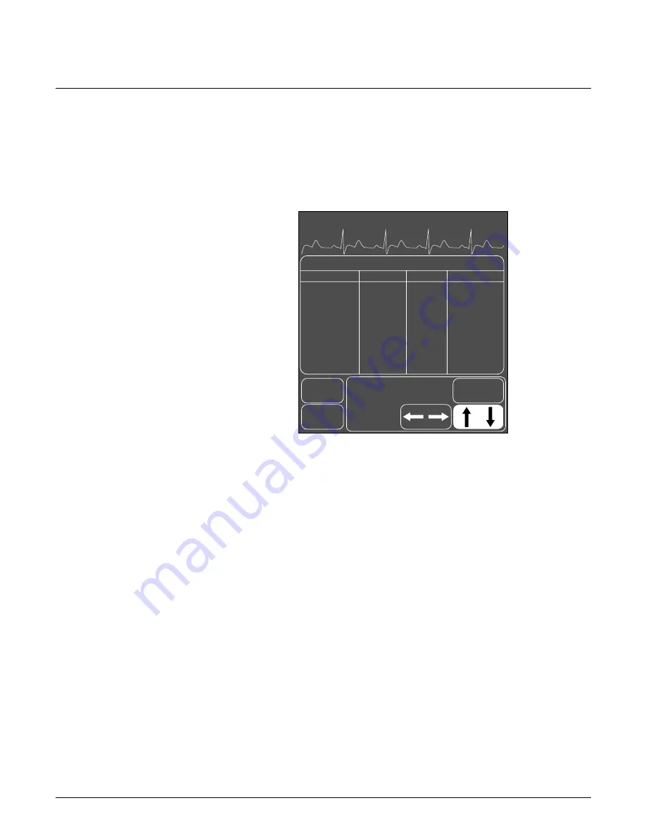 GE Medical Systems marquette Dash 2000 Operator'S Manual Download Page 196