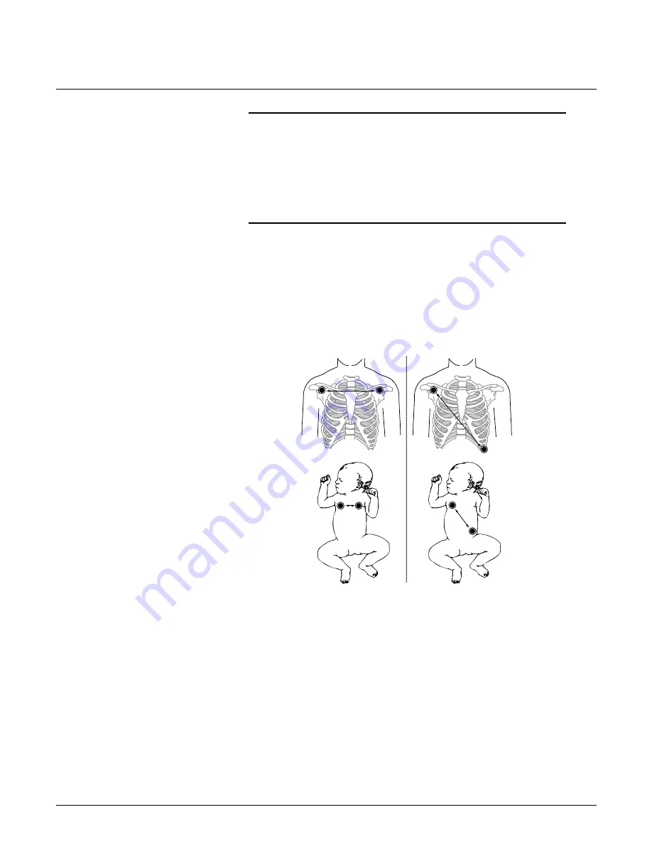 GE Medical Systems marquette Dash 2000 Operator'S Manual Download Page 223