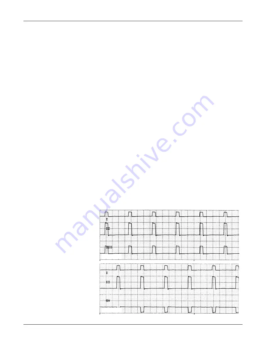 GE Medical Systems marquette Dash 2000 Service Manual Download Page 54