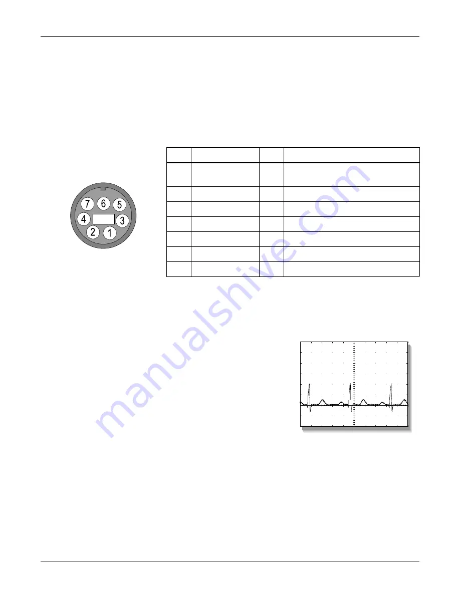 GE Medical Systems marquette Dash 2000 Service Manual Download Page 61