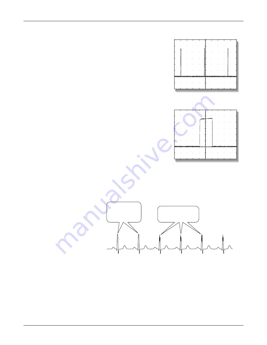 GE Medical Systems marquette Dash 2000 Service Manual Download Page 62