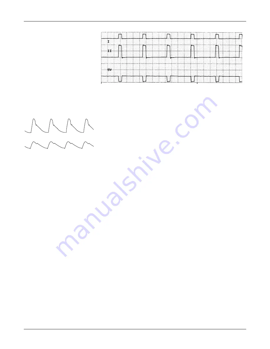 GE Medical Systems marquette Dash 2000 Service Manual Download Page 91