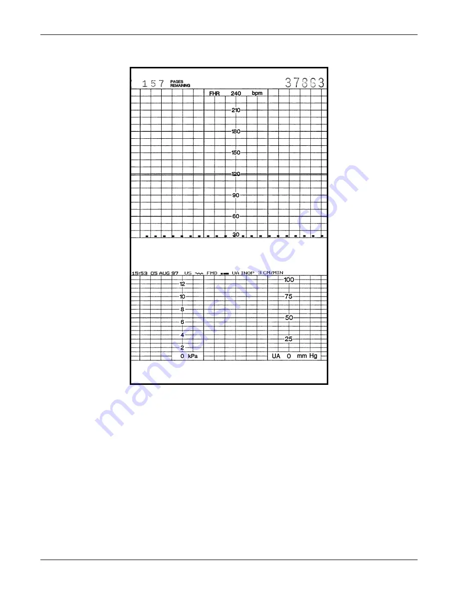 GE Corometrics 170 Series Скачать руководство пользователя страница 119