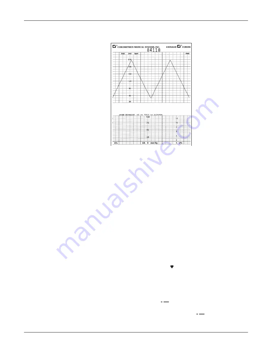 GE Corometrics 250 Series Service Manual Download Page 111