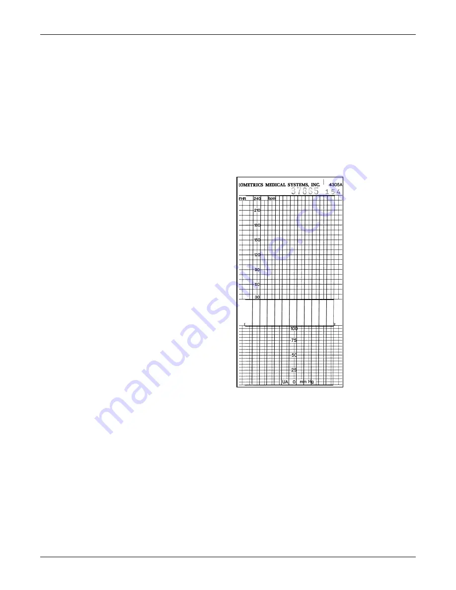 GE Corometrics 250 Series Service Manual Download Page 148