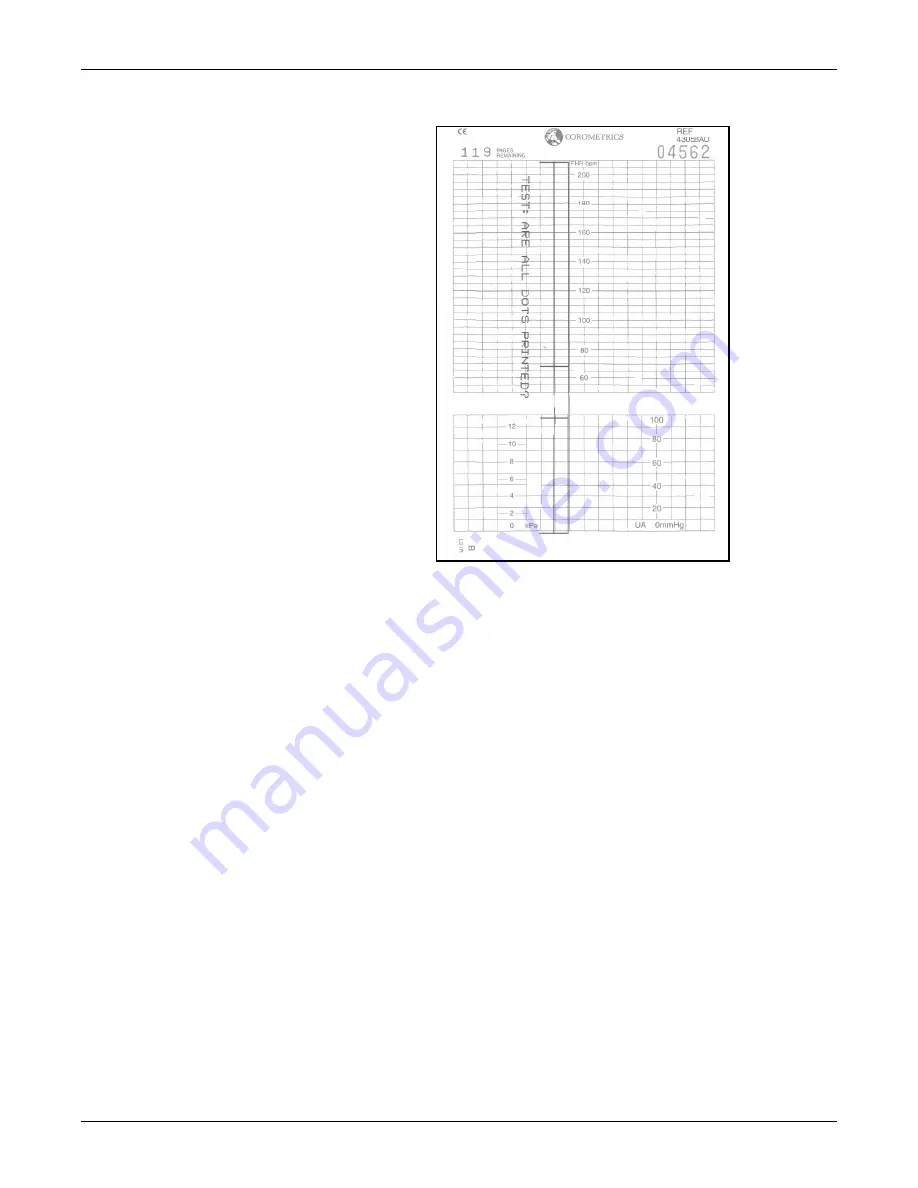 GE Corometrics 250 Series Service Manual Download Page 155