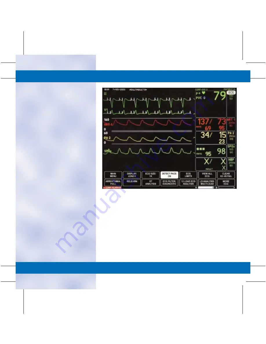 GE DASH 3000 V5 Quick Reference Manual Download Page 17