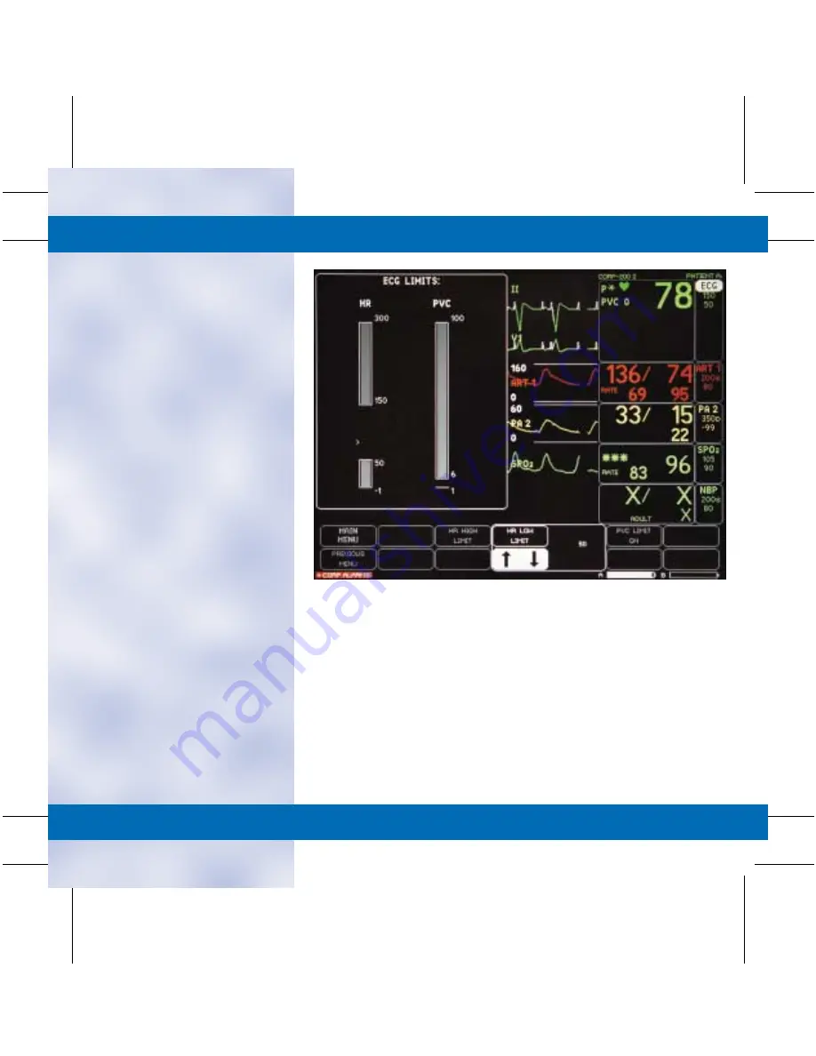 GE DASH 3000 V5 Quick Reference Manual Download Page 19