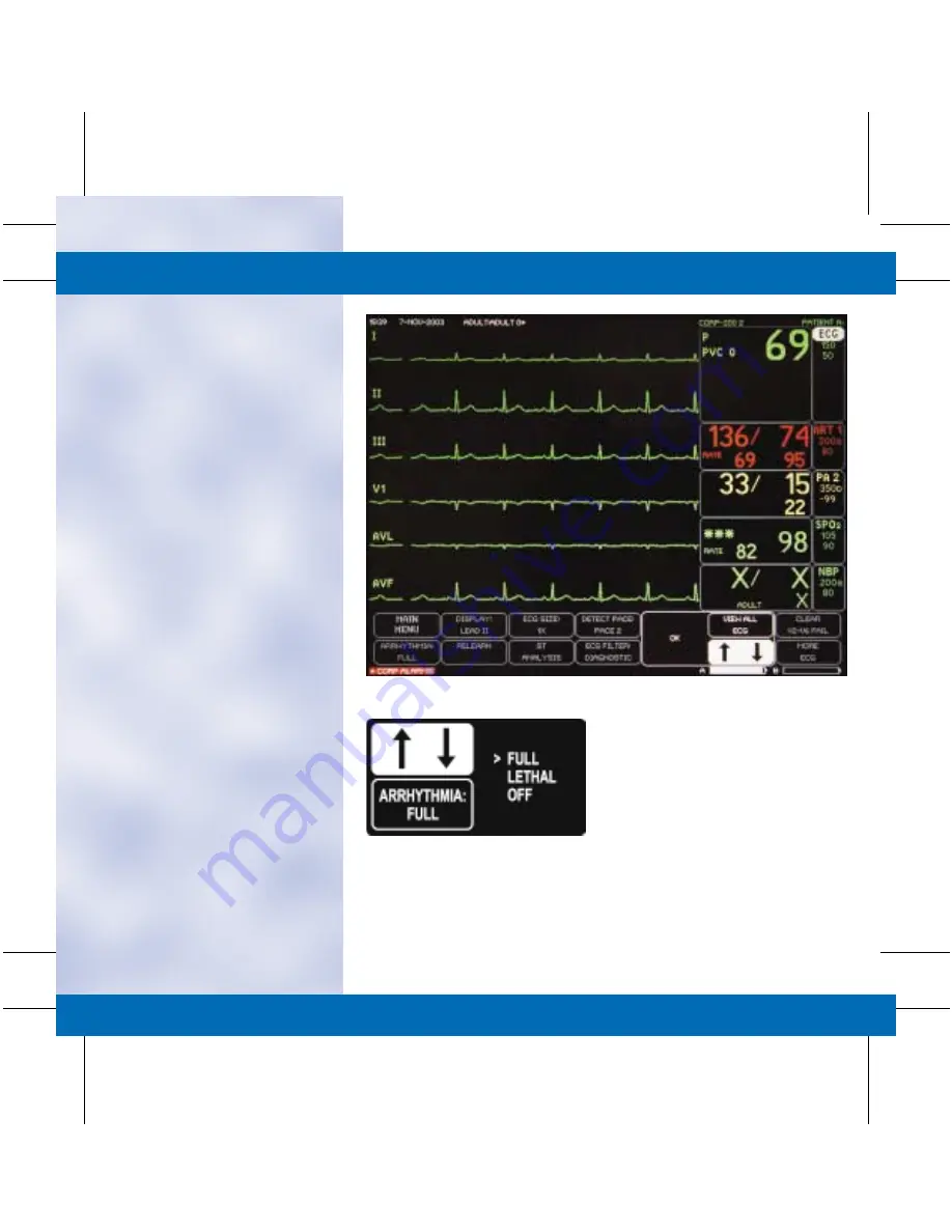 GE DASH 3000 V5 Quick Reference Manual Download Page 20