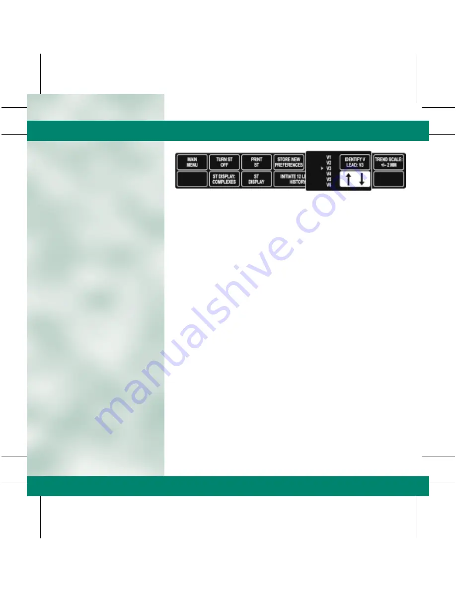 GE DASH 3000 V5 Quick Reference Manual Download Page 28