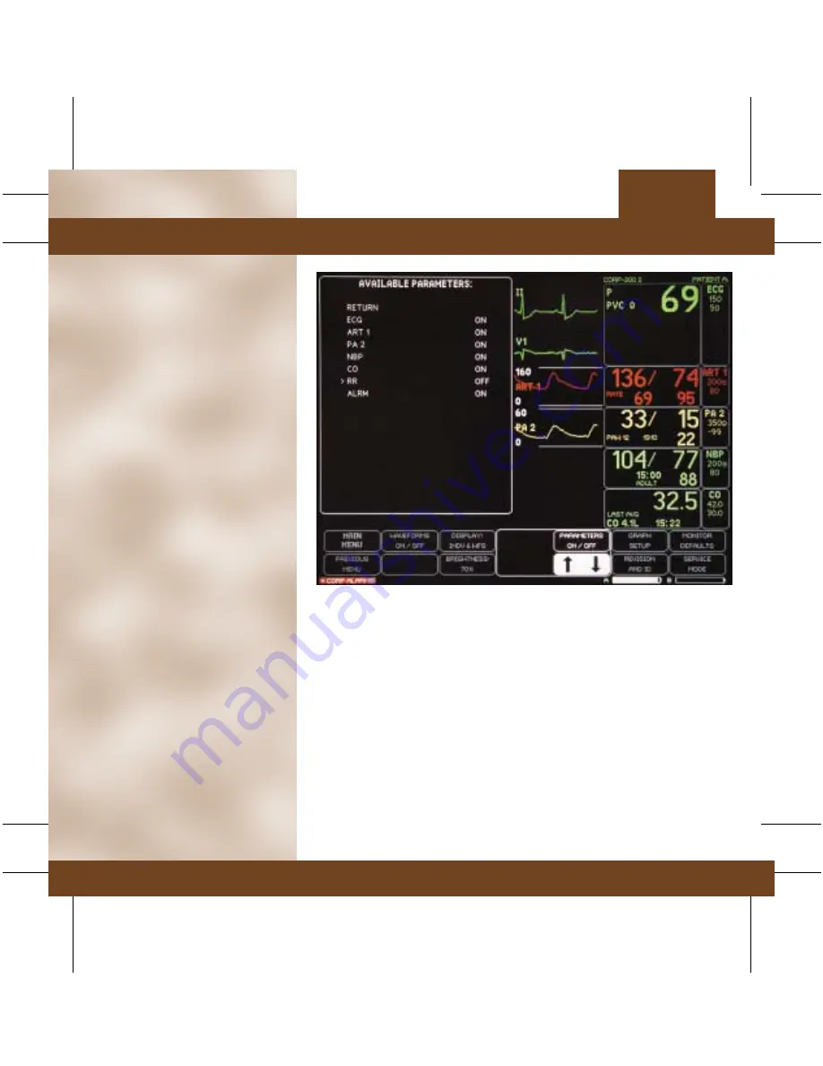 GE DASH 3000 V5 Quick Reference Manual Download Page 68