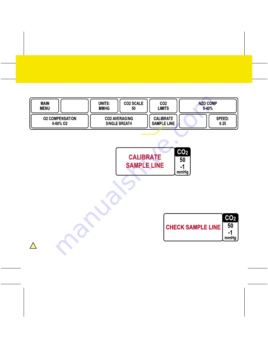 GE DASH 3000 V5 Quick Reference Manual Download Page 86