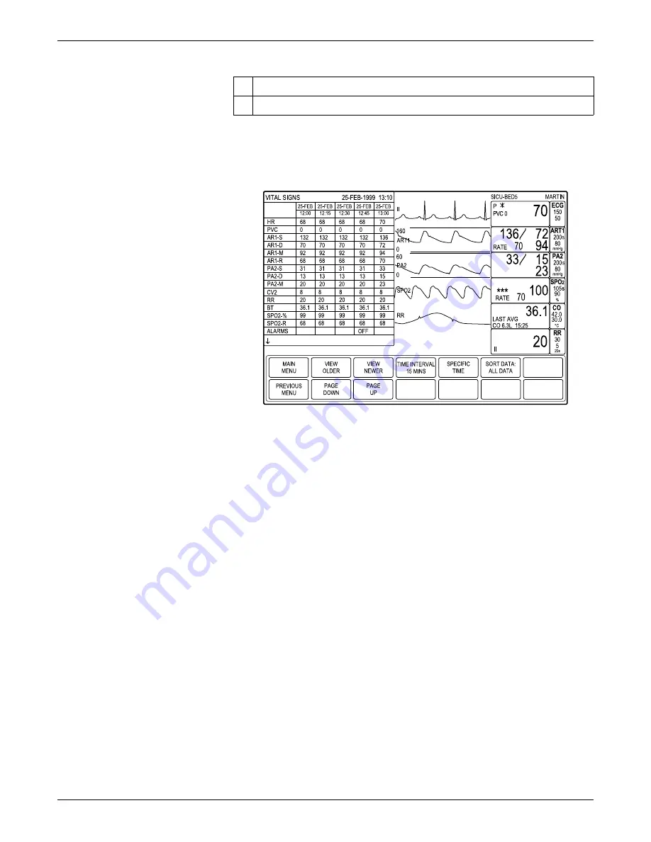 GE Dash 3000 Operator'S Manual Download Page 47