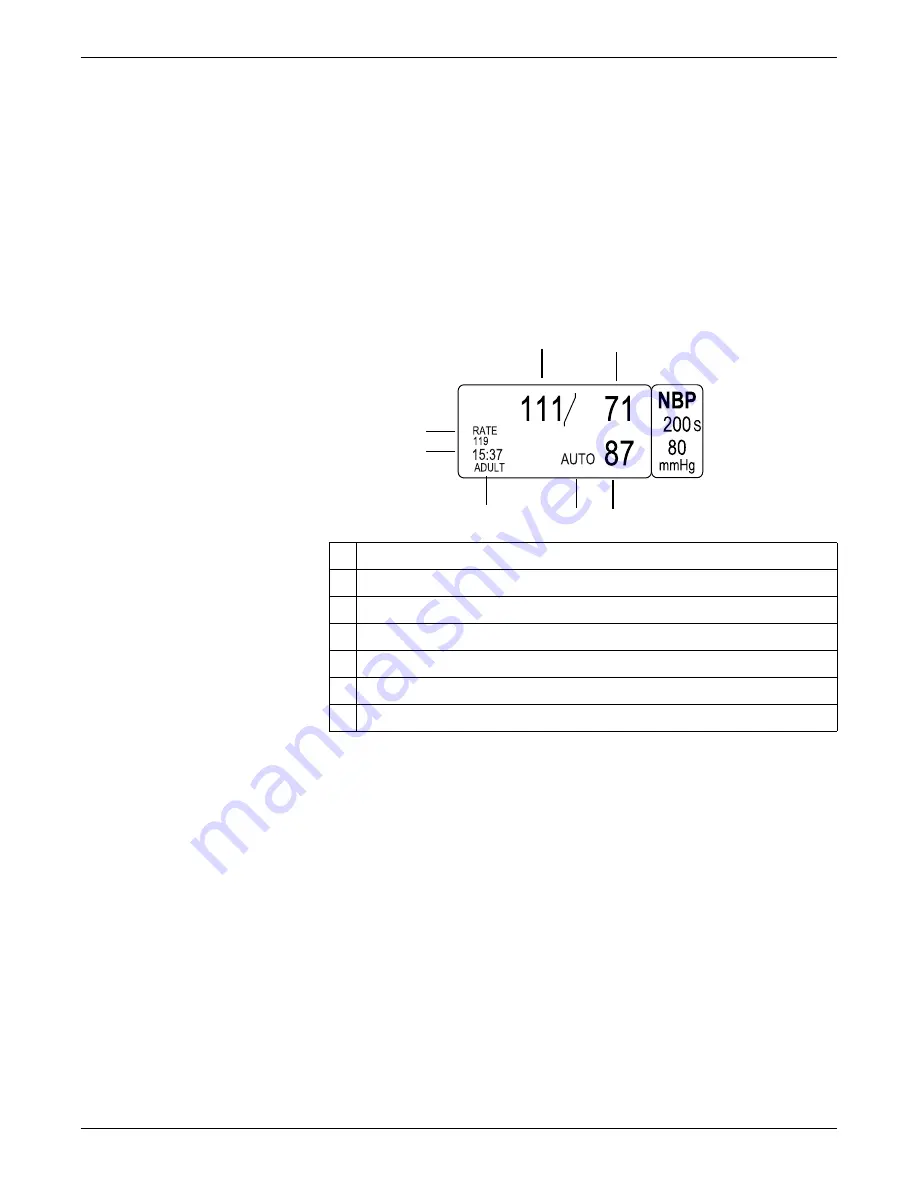 GE Dash 3000 Operator'S Manual Download Page 126