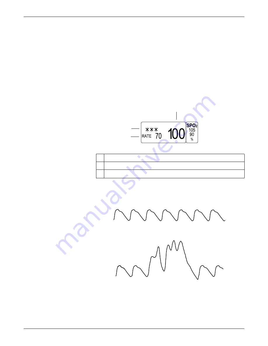 GE Dash 3000 Operator'S Manual Download Page 136